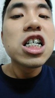 張展耀